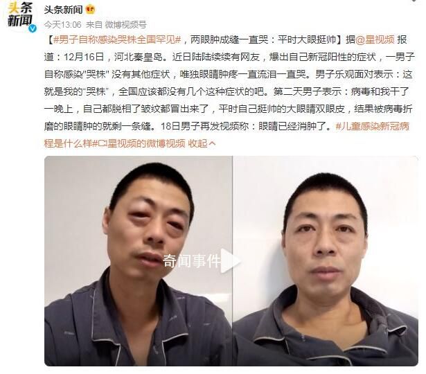 男子自称感染“哭株”全国罕见 眼睛肿疼一直流泪一直哭