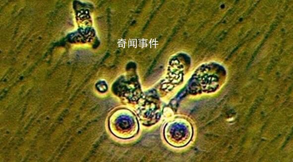 韩国报告首例“食脑虫”病例 从泰国回国后死亡