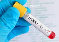 俄全境地区均现甲型H1N1流感 呼吸道感染发病率下降了7%
