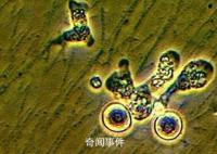 新冠肺炎更名为新冠感染 下月8日起实施乙类乙管