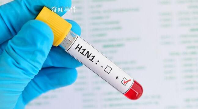 俄罗斯全境均出现甲型H1N1 目前尚无动物传染人类的证据