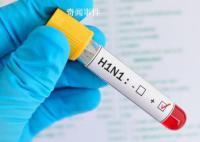 俄罗斯全境均出现甲型H1N1 目前尚无动物传染人类的证据