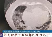 白肺是否会对肺部造成不可逆伤害 这些人做个CT很有必要