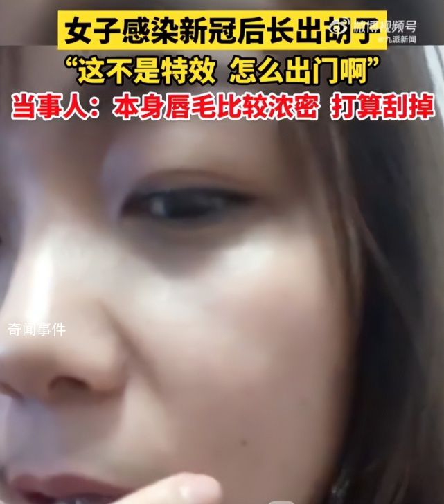 女生回应感染新冠后长出胡子 称这不是特效