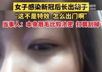女生回应感染新冠后长出胡子 称这不是特效