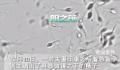 夫妻阳康后着急备孕遭劝阻 网友表示：等一段时间再说