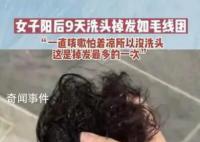 专家:阳康后超30%的人面临脱发风险