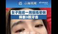 女子阳后一周锻炼晕倒摔断3颗牙 康复期勿剧烈运动