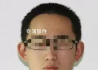 女医生控告前夫投毒案:系模仿作案