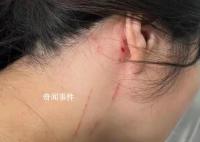 回家过年拒绝相亲 河南母女被打入院