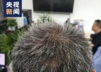 现实版安欣38岁满头白发 愿每次出警都能平安归来