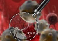 中国癌症死亡50年:肺癌增长最快