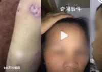 妇联回应女孩自曝全家被父亲家暴 联合公安等上门调查