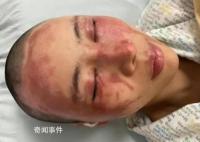 向妻子泼硫酸男子:很后悔 同意离婚