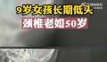 9岁女孩沉迷手机颈椎老如50岁 颈椎的弧度已经往反方向弯曲