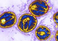 全球第5位艾滋病治愈者出现 是第三例通过实验性治疗清除HIV的患者