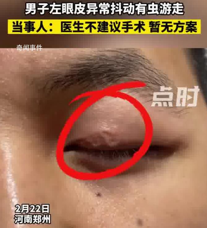 男子左眼皮异常抖动有虫游走 医生不建议手术