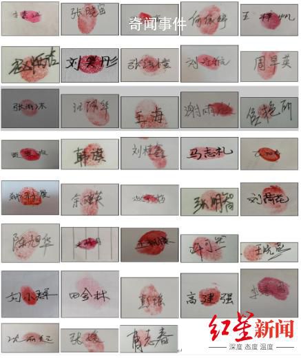 38位戈谢病患者家庭联名求药 戈谢病是什么病能治愈吗