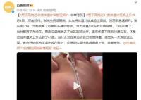男子高烧近41度体温计贴脸狂飙 非常夸张
