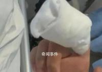 男孩啃秃10个指甲引发骨髓炎 目前孩子已转危为安