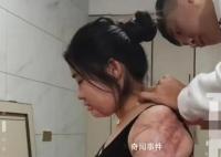 女子回应烧伤后被男友照顾6年 表示很感谢男友的付出
