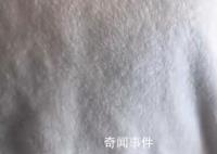女孩出汗把衣服染蓝查出色汗症 色汗症色汗症对身体什么危害