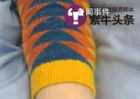 女子住酒店被毒蛇咬伤 酒店拒担全责