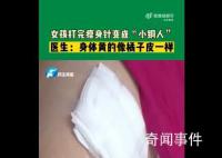 女子打减肥针致肝脏严重受损 减肥没有一步登天