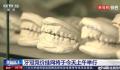 种牙费用有望降低50% 价格调控目标为4500元