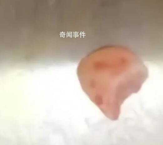 女子摔跤牙磕进嘴唇1月才发现 上嘴唇没有消肿摸的时候还有硬物