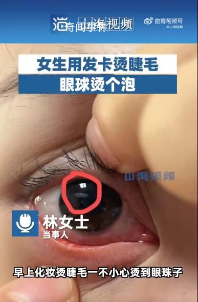 女生用发卡烫睫毛眼球烫个泡 提醒大家化妆时要注意安全