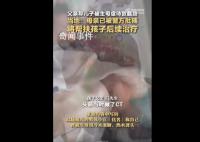 父亲称儿子被生母虐待致截肢 曾被生母用冷水泡脚热水烫头