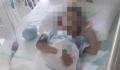 被生母虐待致截肢男童父亲再发声 希望能保住眼睛