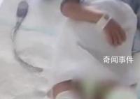 5岁男童被生母虐待致截肢 妇联回应