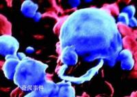 禽流感或成新的大流行毒株来源 人类对这种病毒几乎没有免疫力