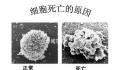 细胞衰老可能与基因表达错误有关 无法正常合成蛋白质
