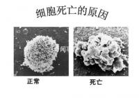 细胞衰老可能与基因表达错误有关 无法正常合成蛋白质