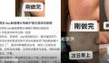 网友曝在赫莲娜做护理致脸部烧伤 因仪器有损坏和美容师操作不当