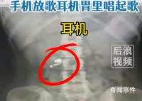 男子误吞耳机肚子传出歌声 称目前自己是吃泻药希望能排出耳机