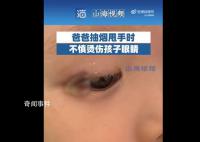 爸爸甩烟不慎致孩子眼角烫伤 引发网友热议