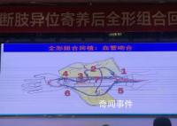 男子断臂后寄养小腿1月成功回植 该手术属世界首例