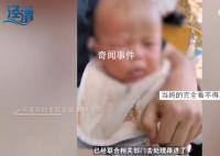 妇联回应5个月婴儿被打肿脸 实在是令人发指