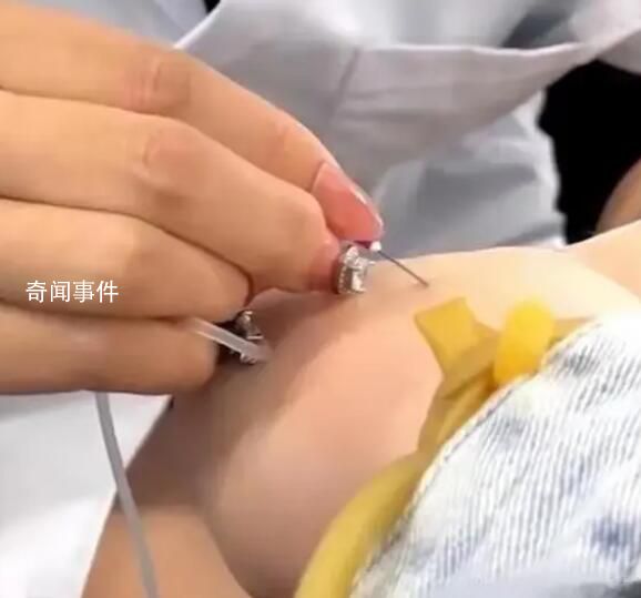 医院回应护士戴美甲给患者扎针 已督促该护士卸掉美甲