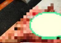 巴厘岛身亡中国男子挣扎爬行20分钟 脖子等处有伤口