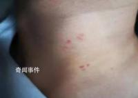 16岁女生拒去酒吧遭室友殴打 警方以寻衅滋事对施暴者立案侦查