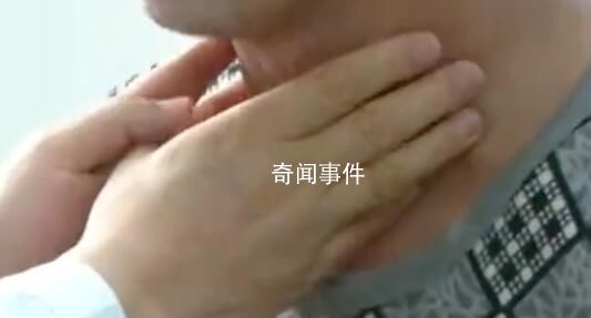 男子1天吃10顿暴瘦110斤 经检查确诊为甲亢