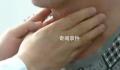 男子1天吃10顿暴瘦110斤 经检查确诊为甲亢