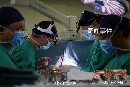 全国首例心脏不停跳人工心脏植入 这些患者手术前都是重度心衰