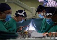 全国首例心脏不停跳人工心脏植入 这些患者手术前都是重度心衰