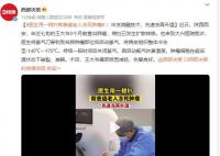 医生用一根针帮患癌老人冻死肿瘤 希望早日攻克癌症